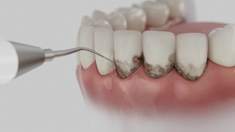 Reliable Tooth Extraction contractor in Madison County County, TX by Dentist Open Now